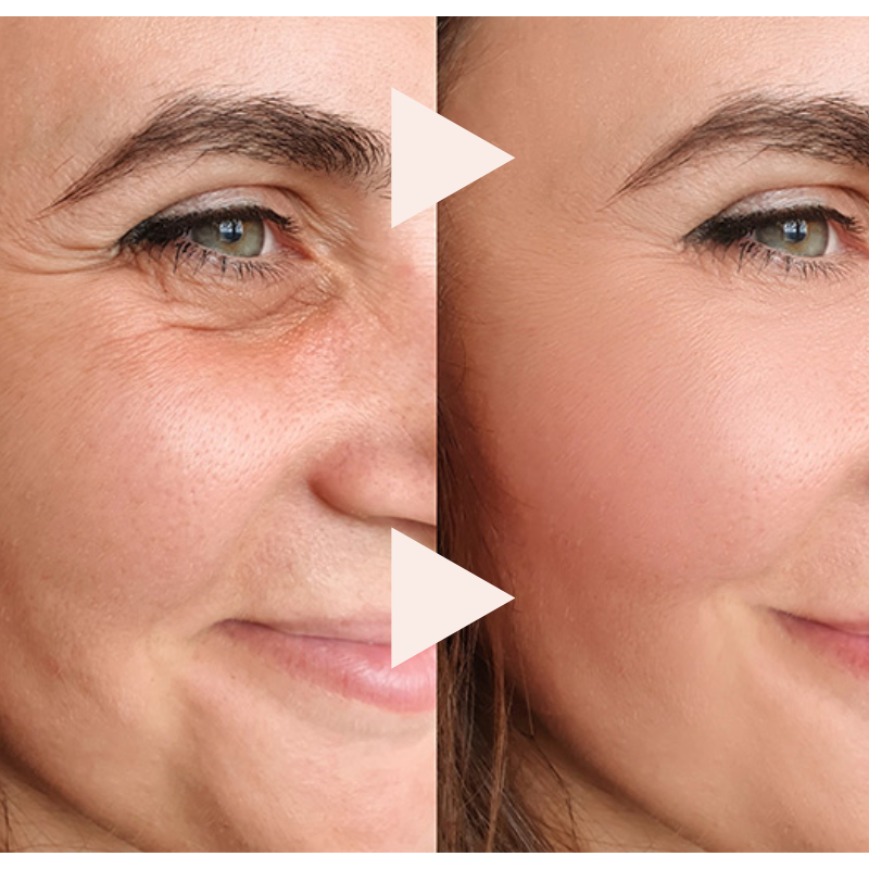 Final Hours Sale: The Express Wrinkle-Free Serum